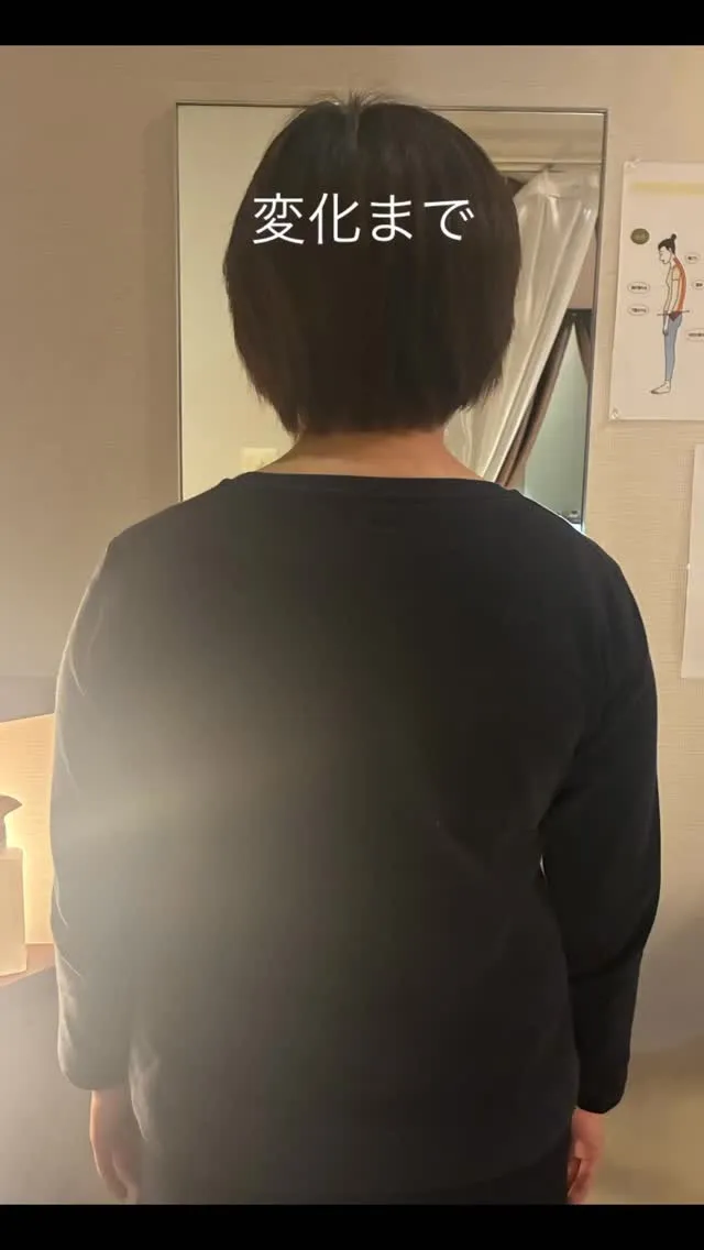 背中痩せ施術【ビフォーアフター】