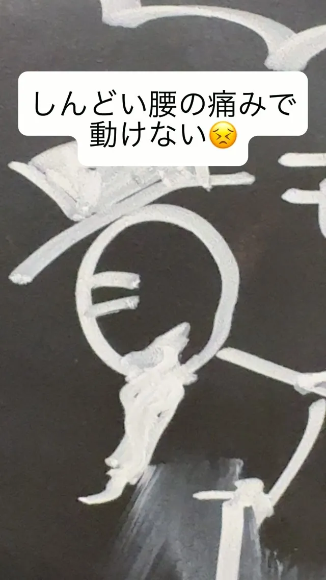 黒板再現　腰の劇的ビフォーアフター【イラスト】